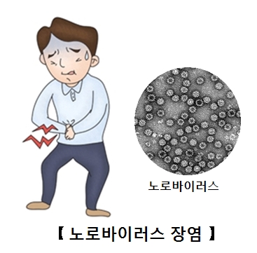 노로 바이러스 장염