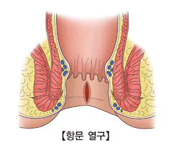 항문열구