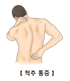 외상에 의한 척추손상