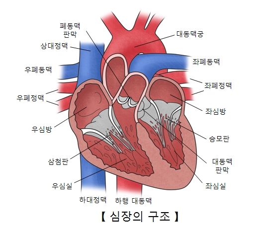 울혈성 심부전