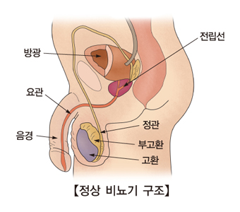 귀두포피염