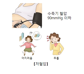 저혈압