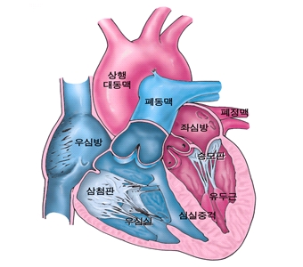 수정대혈관 전위