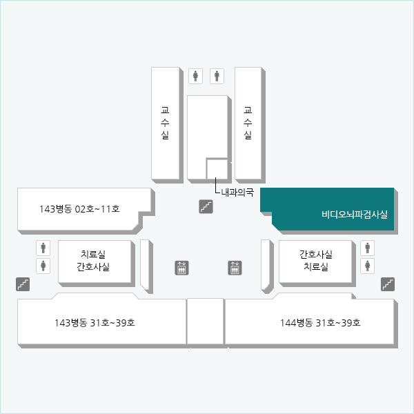 경련하는 순간의 뇌파와 경련 모습을 관찰함으로써 더욱 정확하게 경련이 발생하는 뇌의 위치를 확인하기 위한 것으로 입원하여 실시합니다.