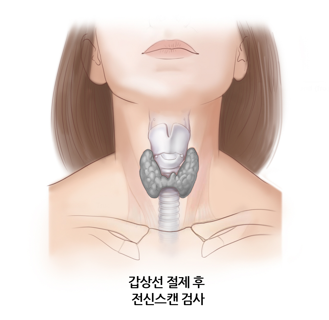 갑상선