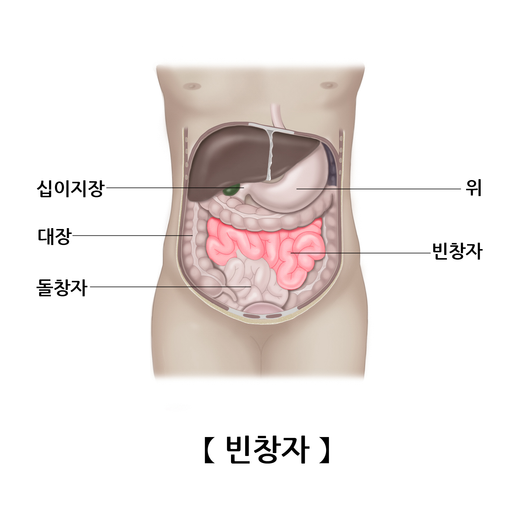 공장