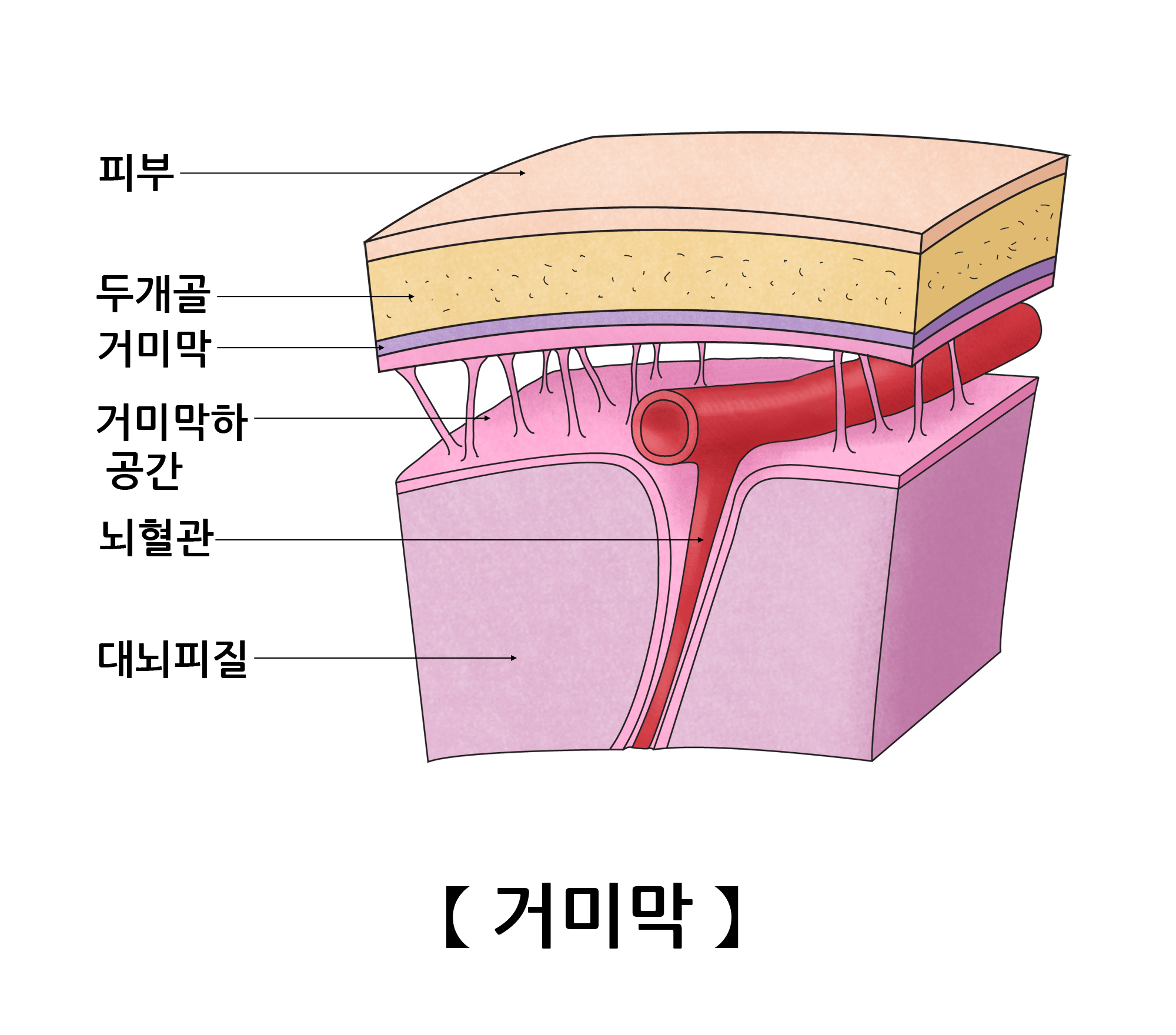 거미막