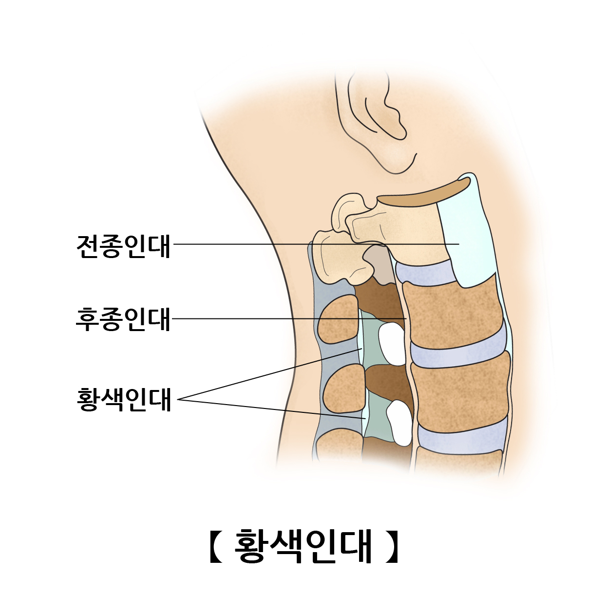 황색인대