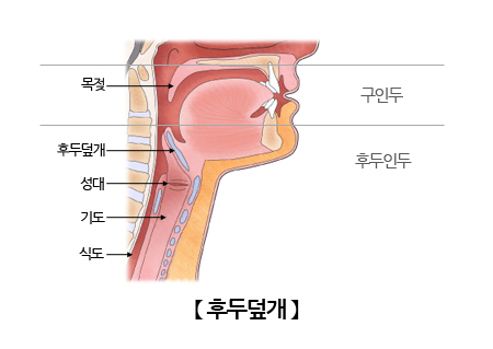 후두덮개